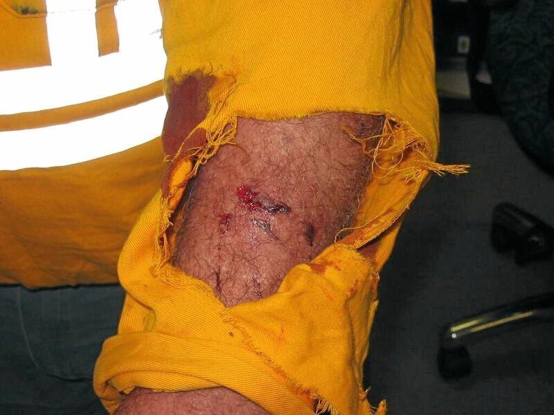 Energex and Ergon staff suffered 71 injuries from dog bites and nearly 200 other incidents and close-calls in Queensland between July 2017 and October 2018.
