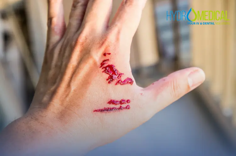 A doctor providing professional animal bite wound care at Hydro Medical Clinic in Bali.