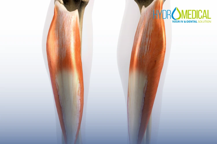 Calf muscle tear gastrocnemius strain treatment Padel Bali.