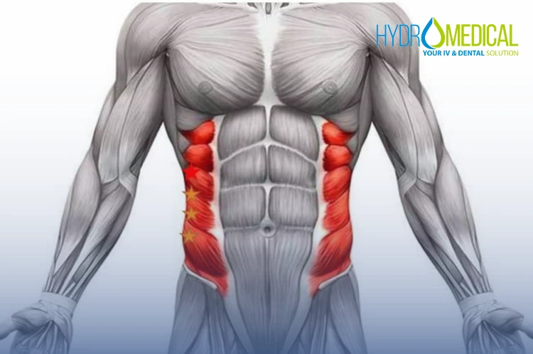 Abdominal oblique muscle strain taping physiotherapy Bali.