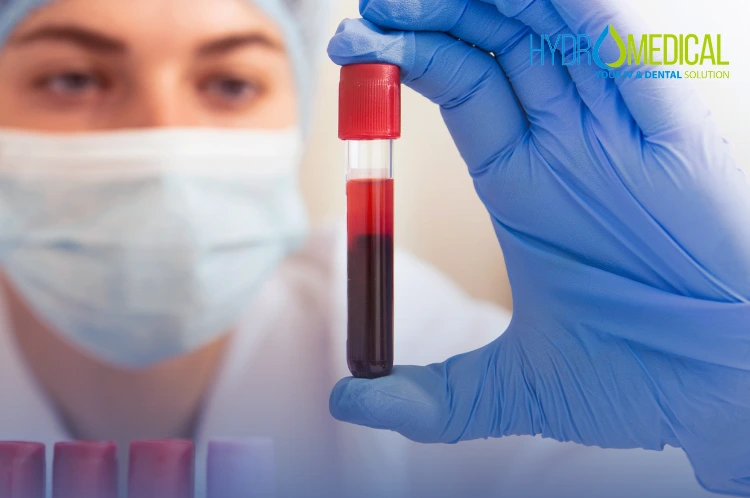 On-site lab technician processing diagnostic lab tests at Hydro Medical Clinic Bali.