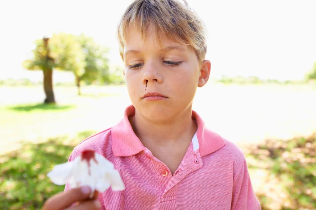 A kid holding a tissue after having a nosebleed in Bali