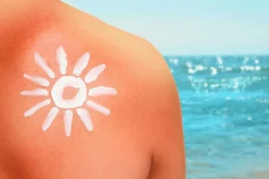 Addressing severe sunburn and skin inflammation in Bali with medical care.