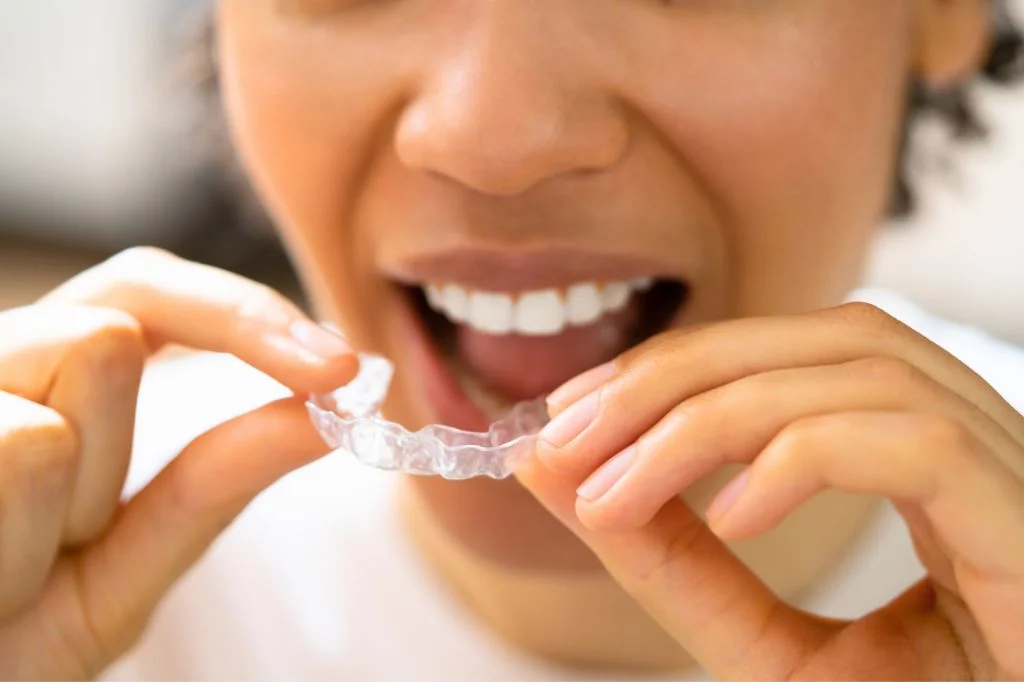 Professional night guard for bruxism and jaw pain relief.