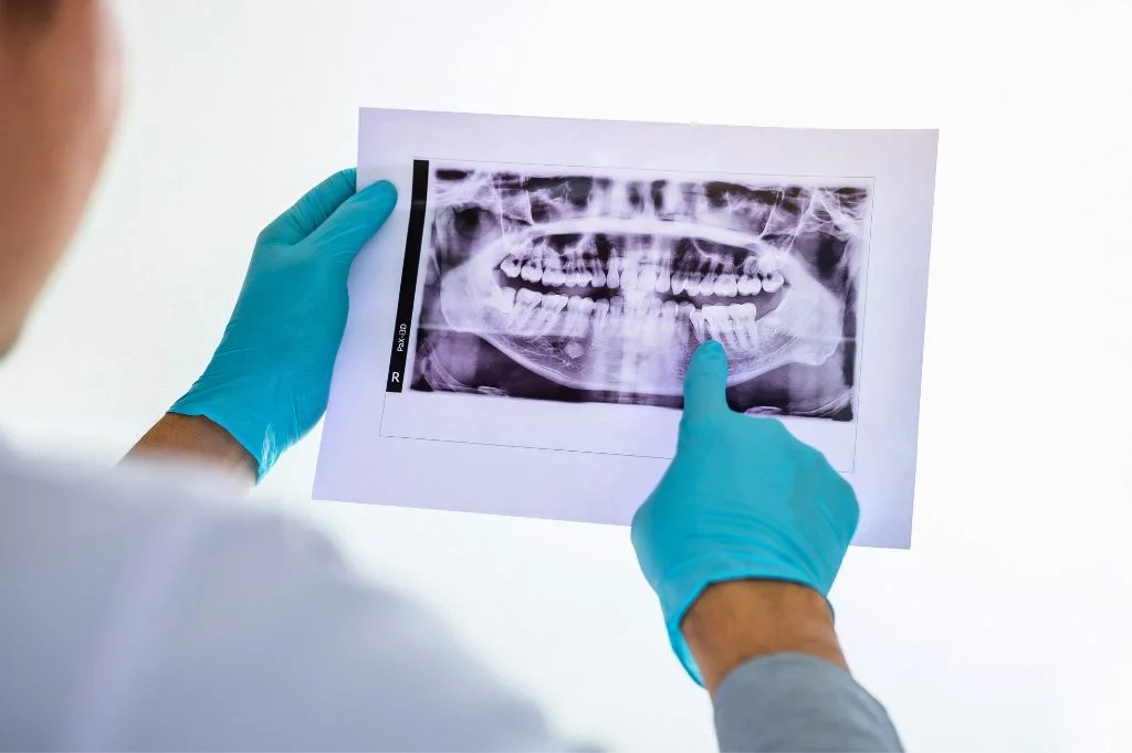 Advanced digital dental scanning technology with low radiation.
