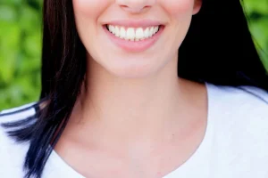 A flawless smile makeover result using premium dental veneers at Hydro Medical.