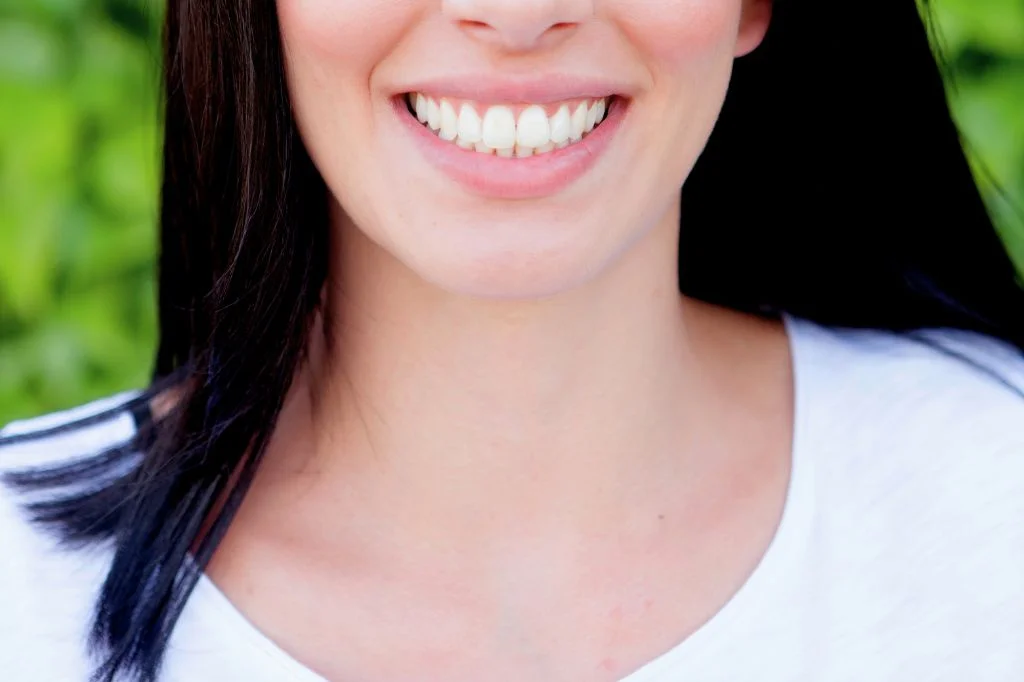 A flawless smile makeover result using premium dental veneers at Hydro Medical.