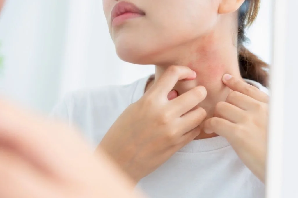 Tourist having a skin rash in Bali while traveling