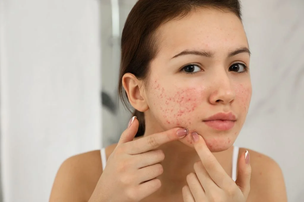 A tourist looking at the mirror, checking the acne in the face