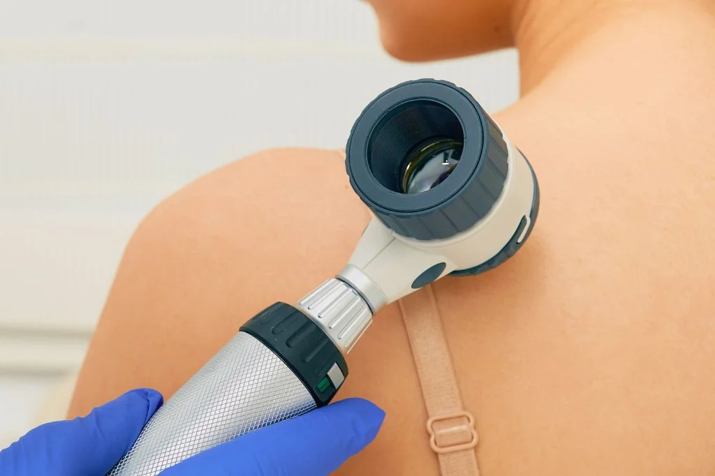Dermatologist performing a dermoscopy exam to diagnose a fungal skin infection