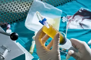 Overview concept of conditions regenerative therapy may help with in Bali